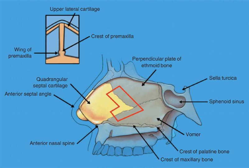 . Deviation at the posterior osteocartilaginous junction may contribute to septa