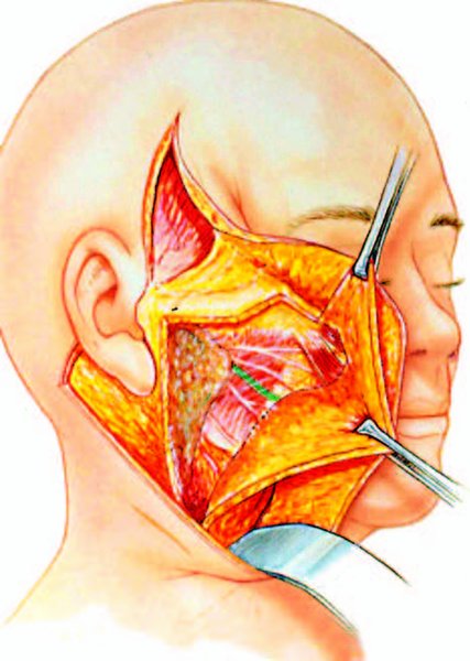 . Illustration of anatomical variations of the mandibular branch of