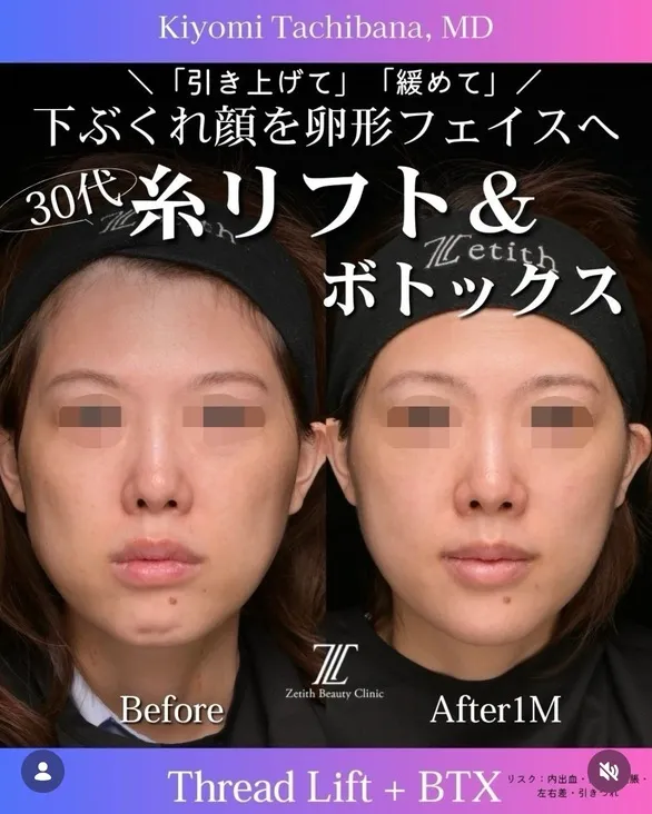 症例写真
