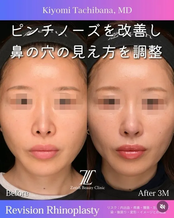 症例写真