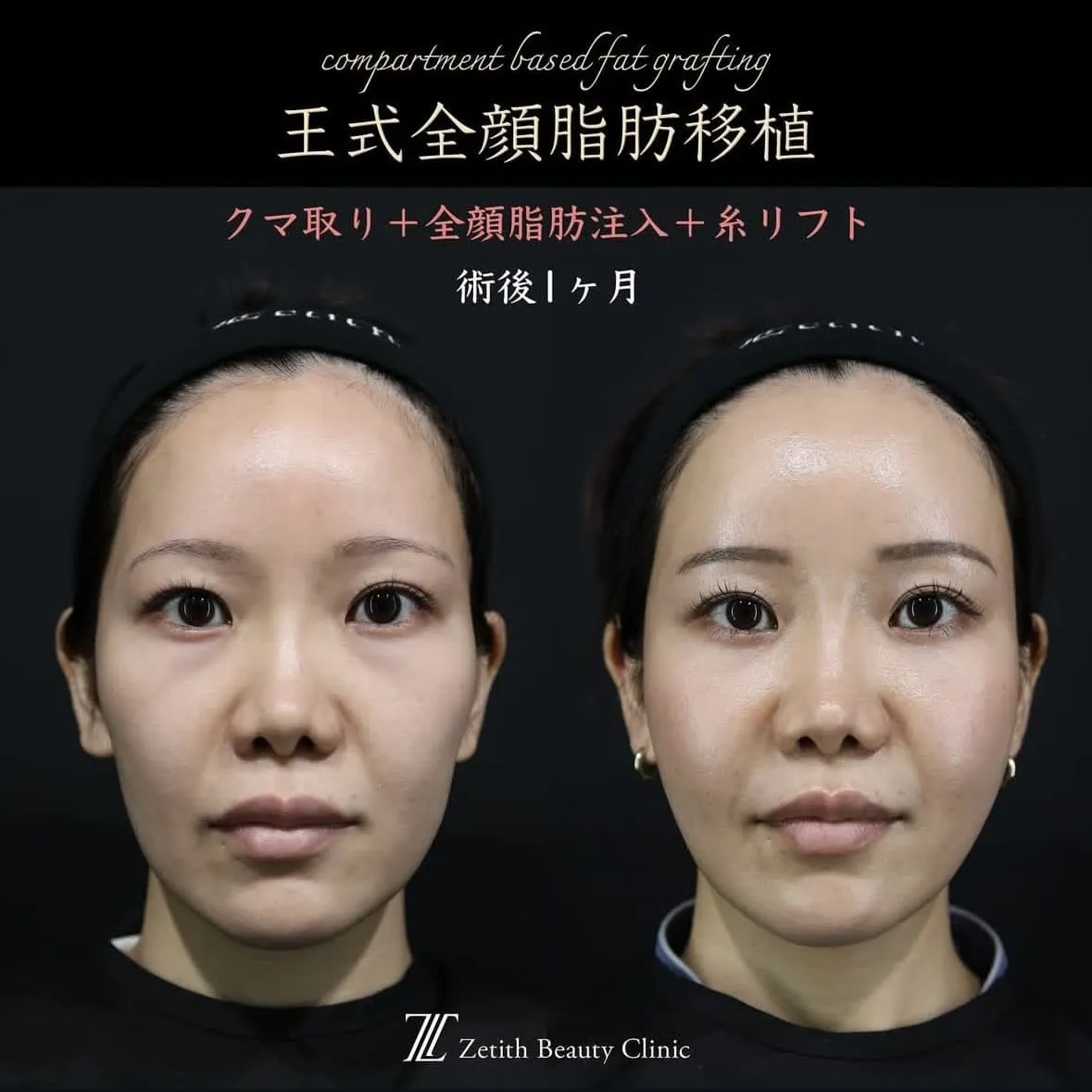 症例写真