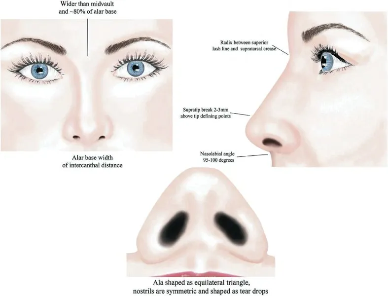 Ideal nasal proportions: alar base width = intercanthal distance, nasolabial angle 95-100 degrees, equilateral nostril triangle