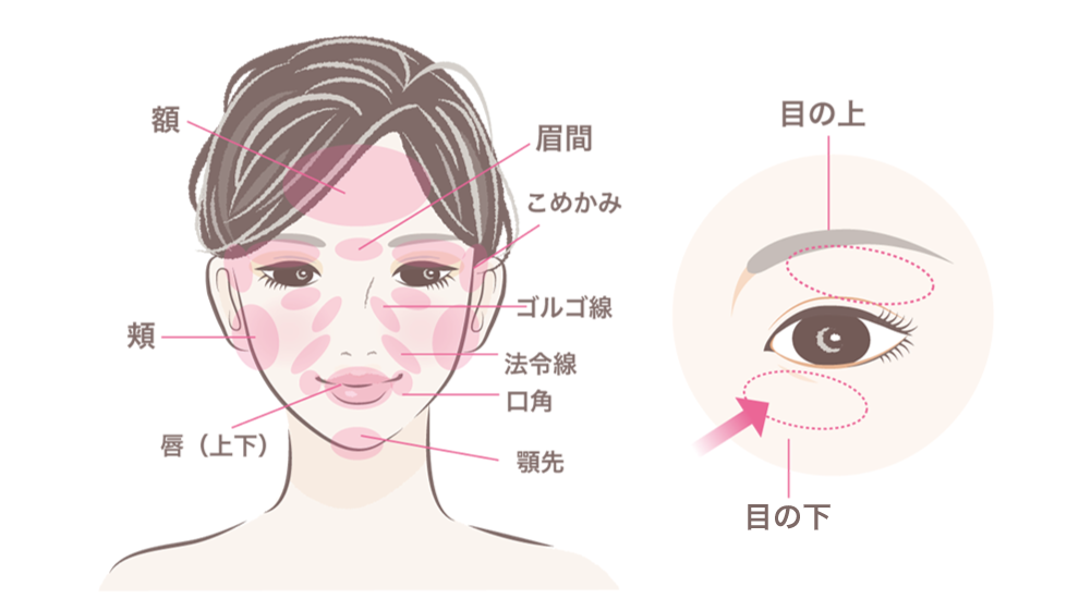 対応部位