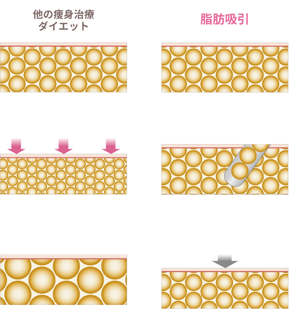 リバウンドしないメカニズム