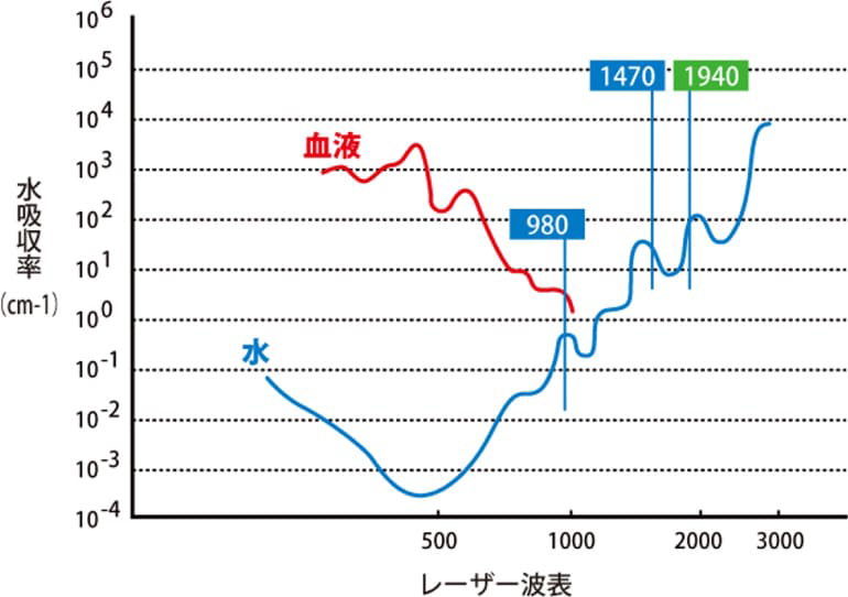 レーザー光の波長