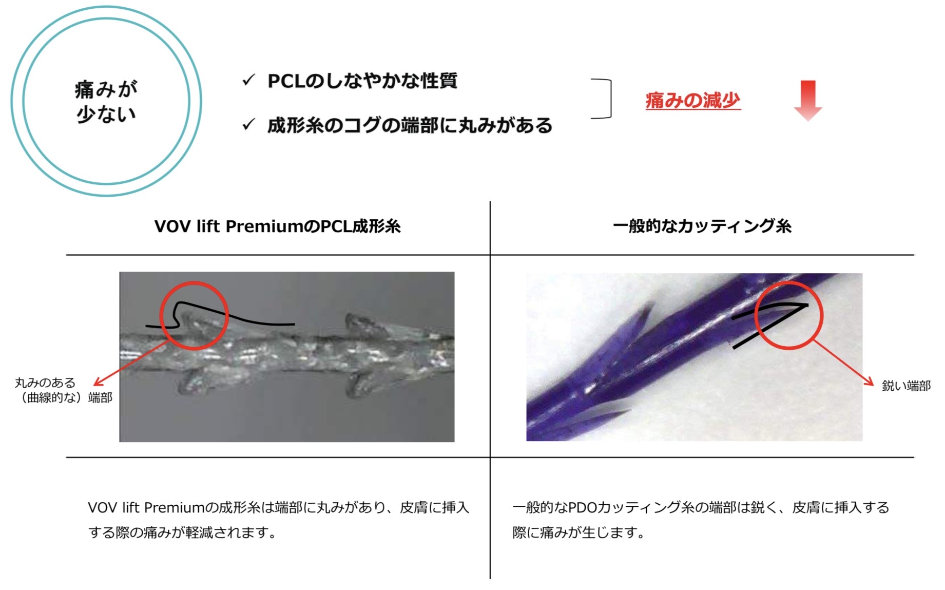 安全性が高く、痛みが少ない
