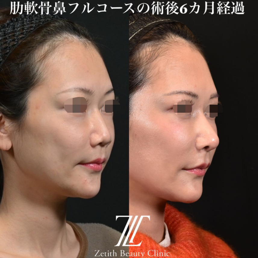 症例写真