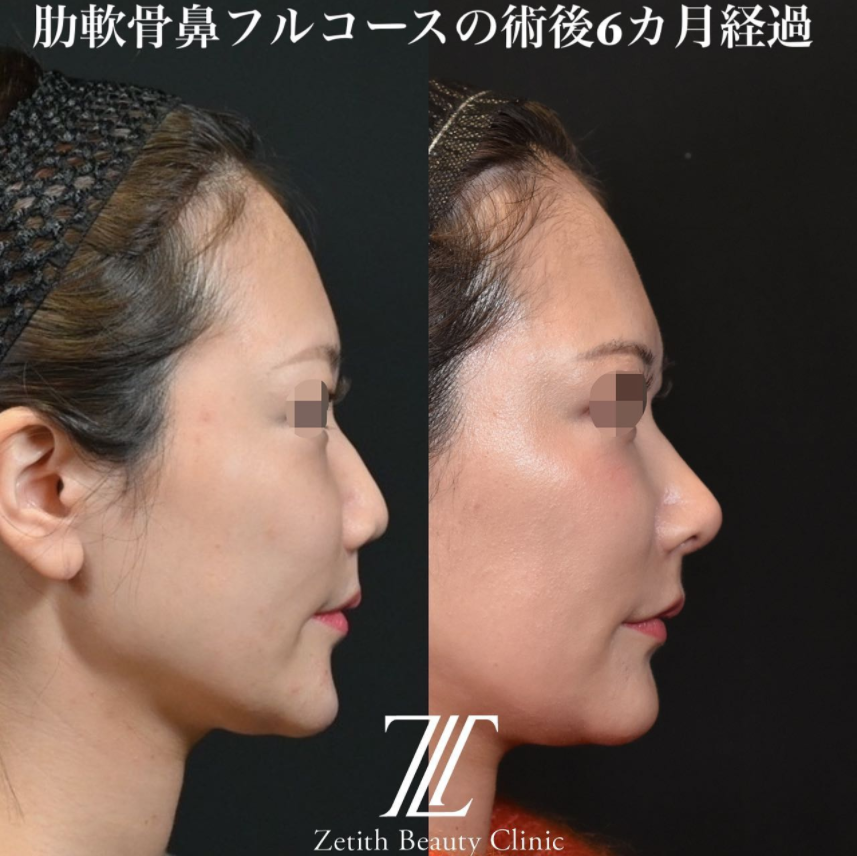 症例写真