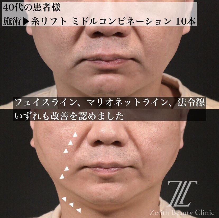 症例写真