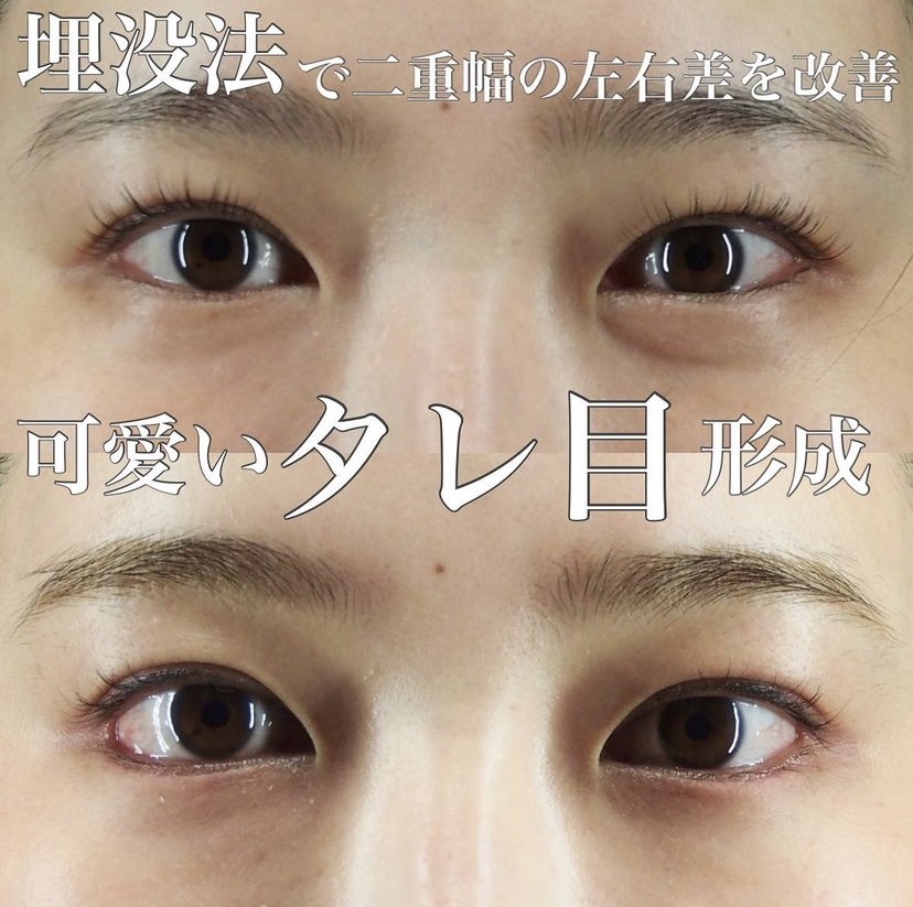 症例写真