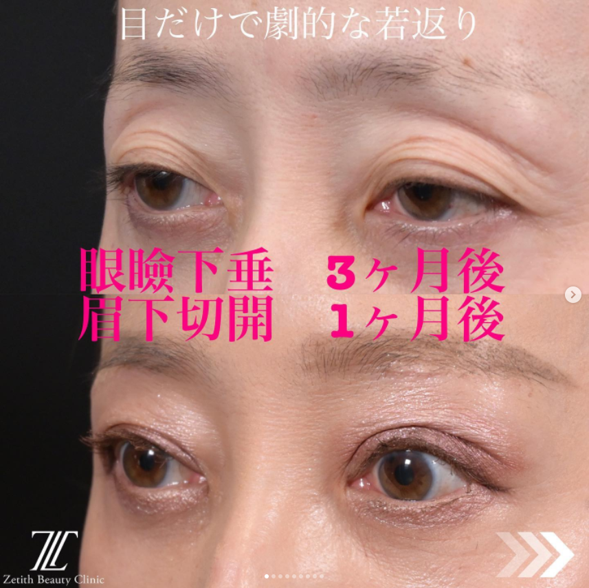 症例写真