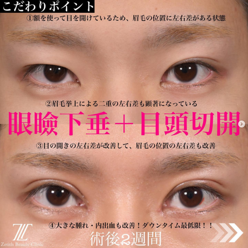 症例写真