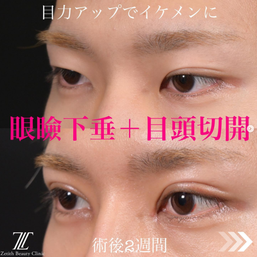 症例写真