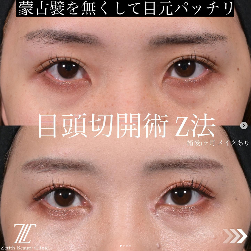 症例写真