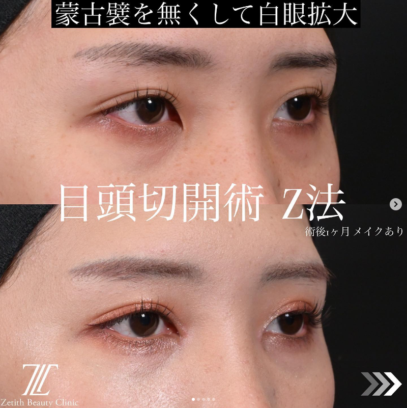症例写真