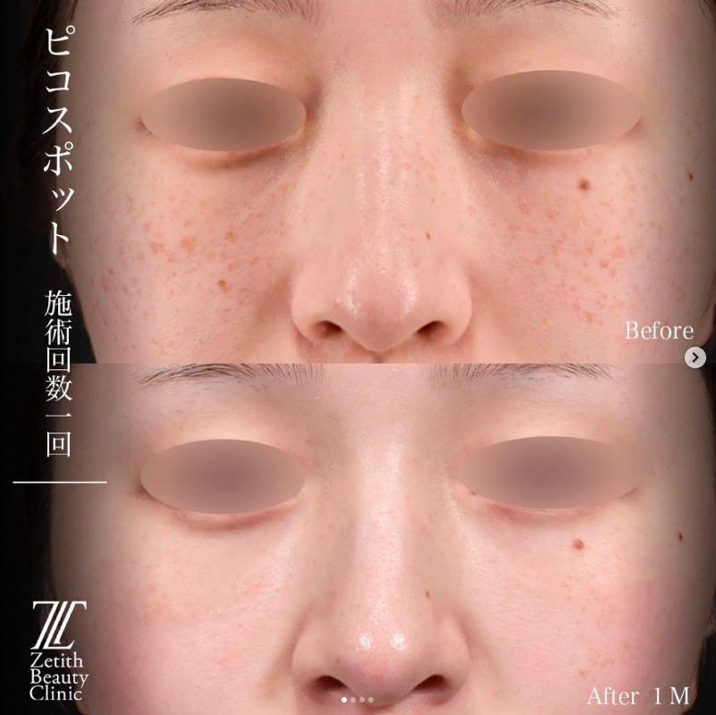 症例写真