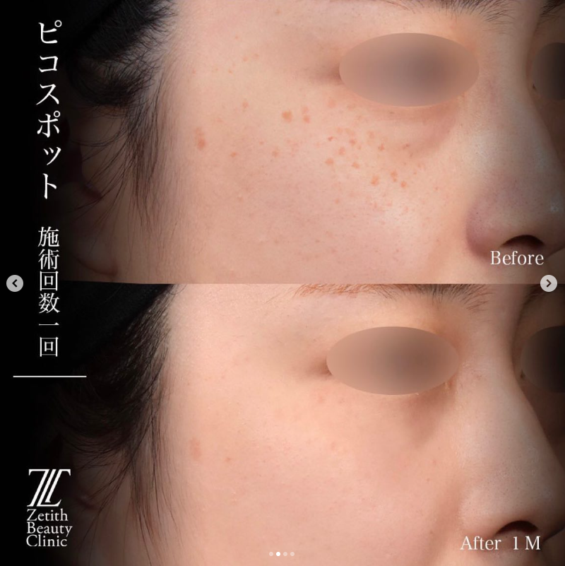 症例写真