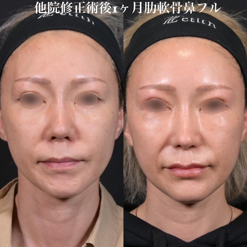 症例写真