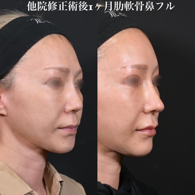 症例写真