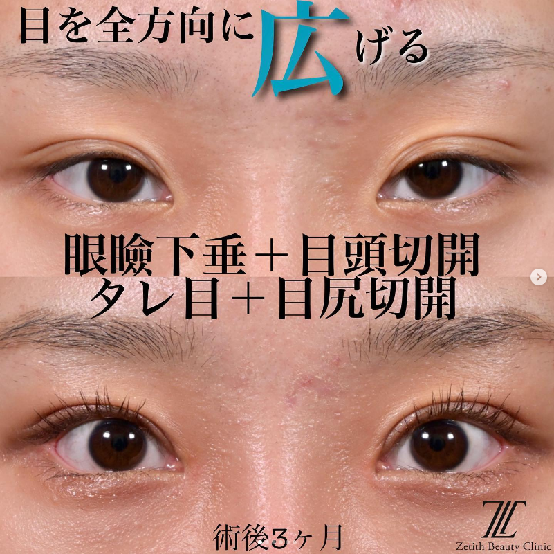 症例写真