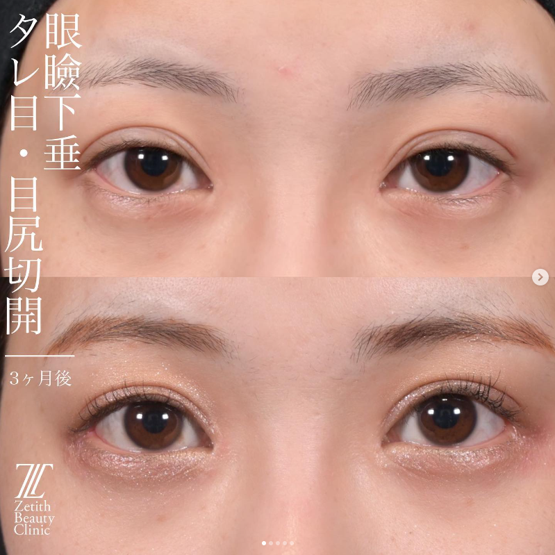 症例写真