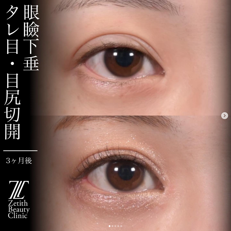 症例写真