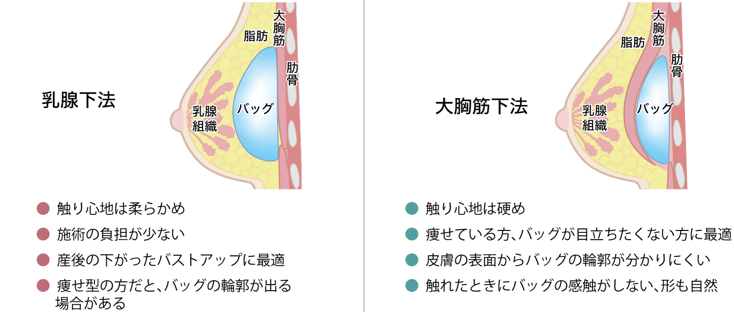 あなたの希望や体型に合った施術をご提案