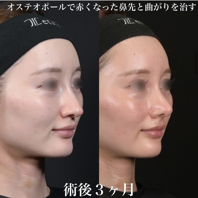 症例写真