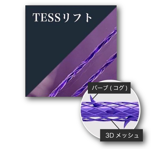 ?TESSリフト