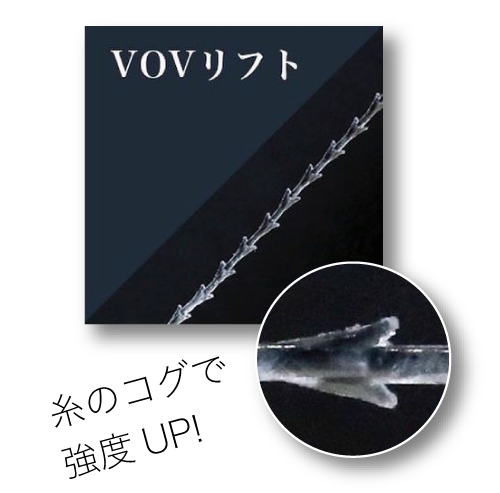 ?VOVリフト