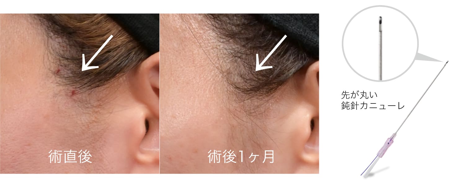 ❶ 長期持続性