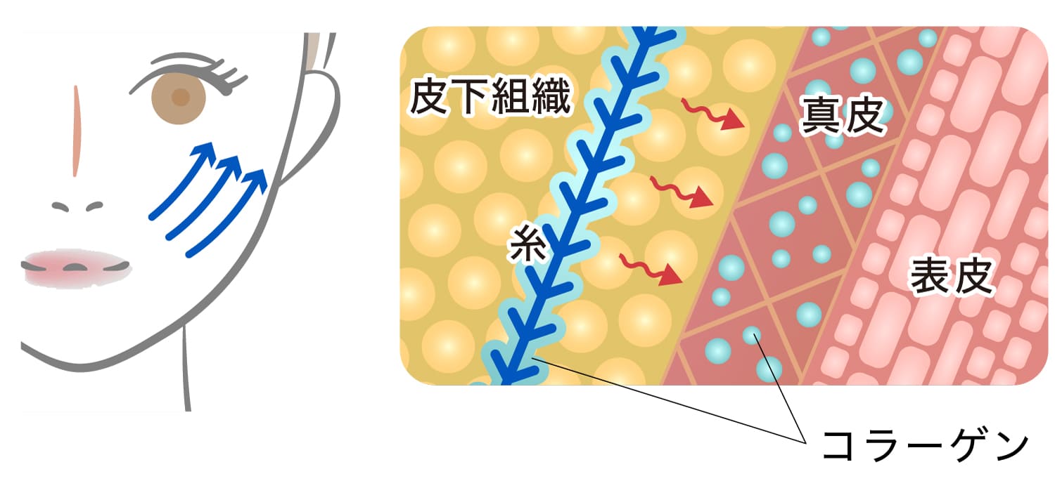 ❸ 使用目的に適したリフト力