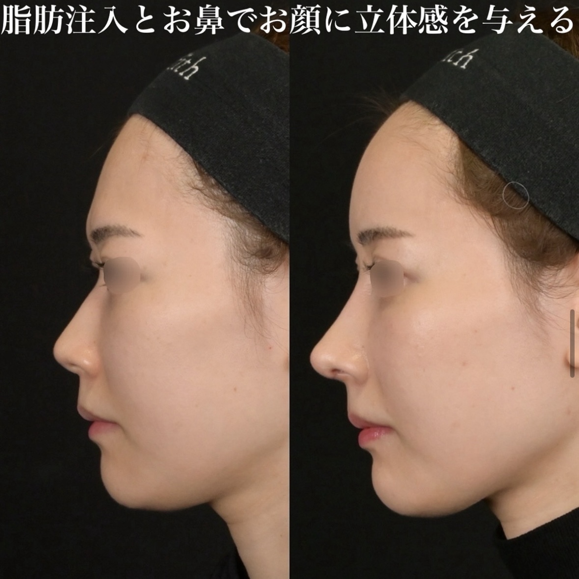 症例写真
