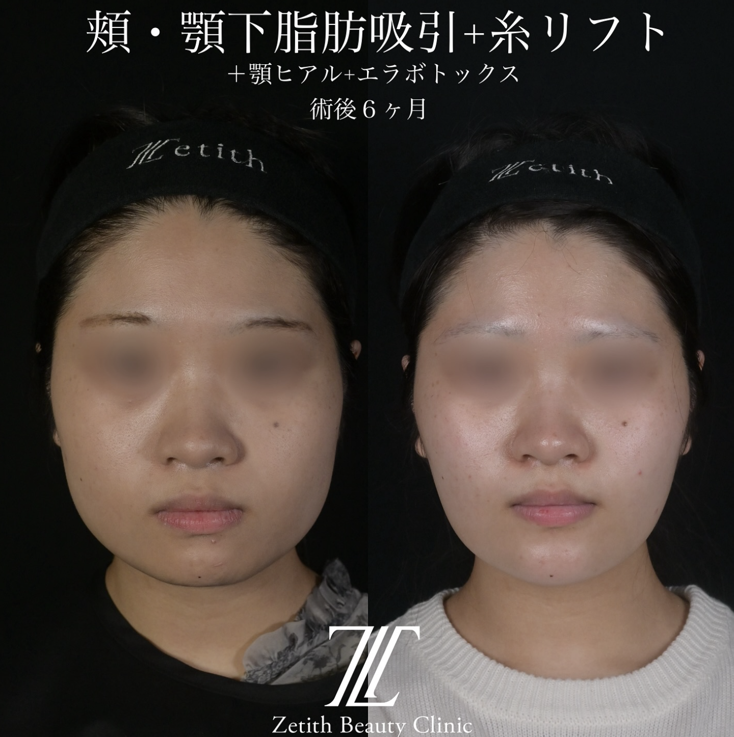 症例写真