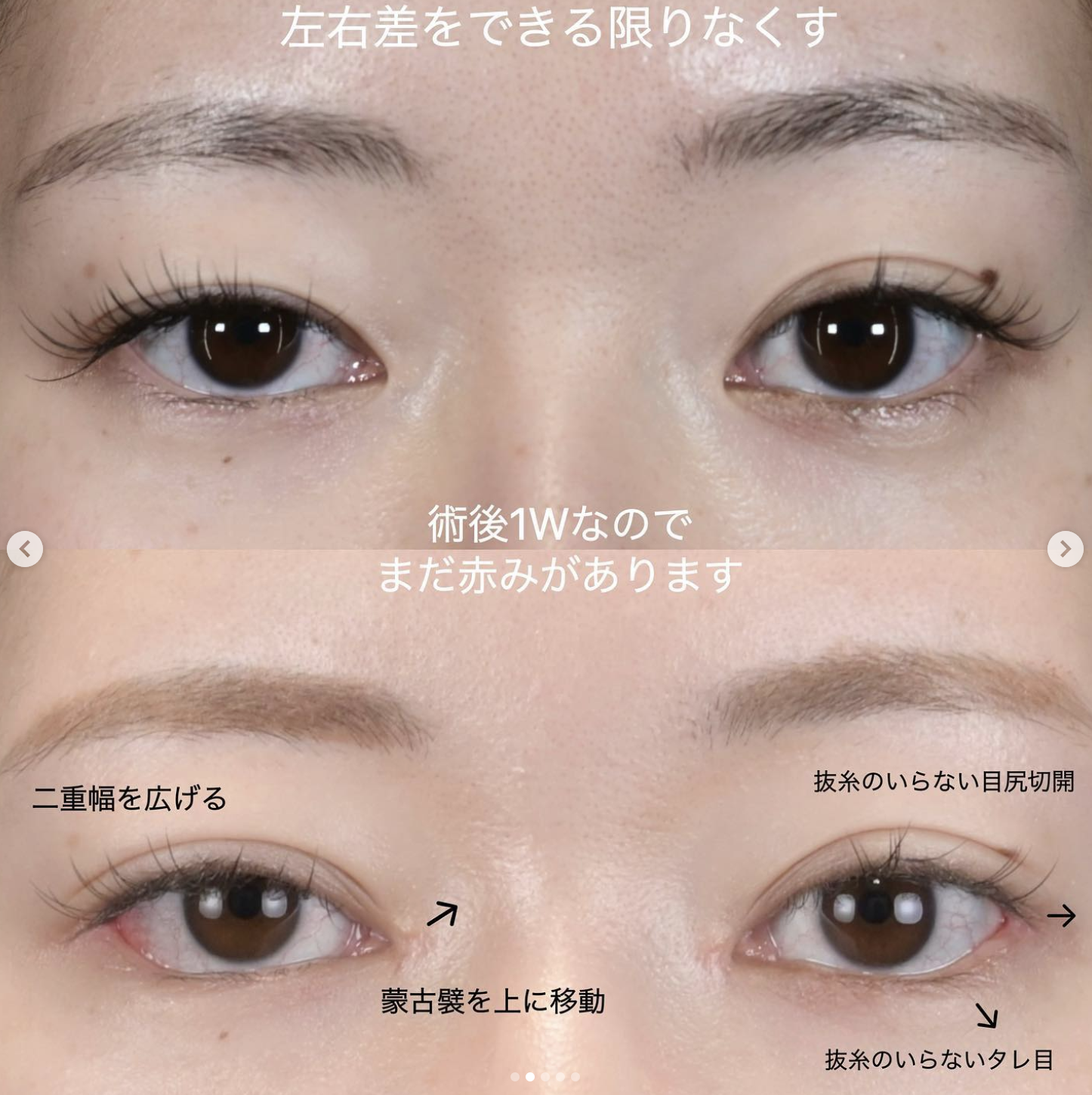 症例写真