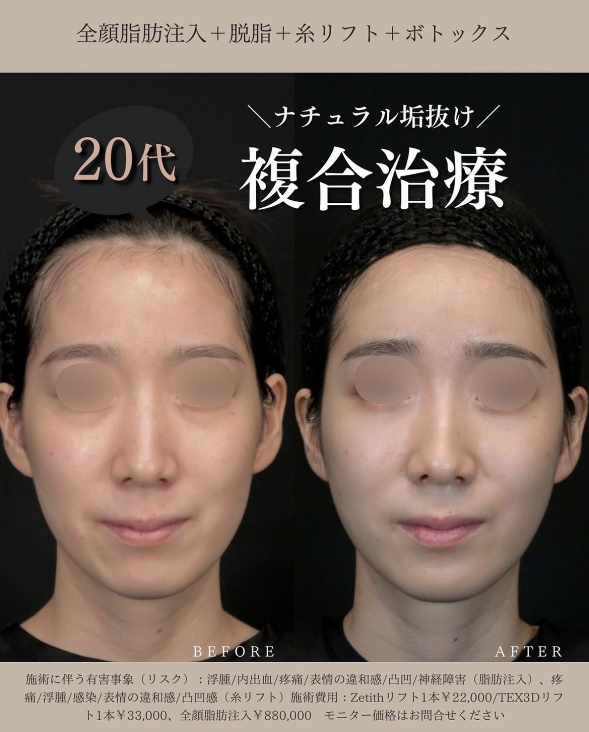 症例写真