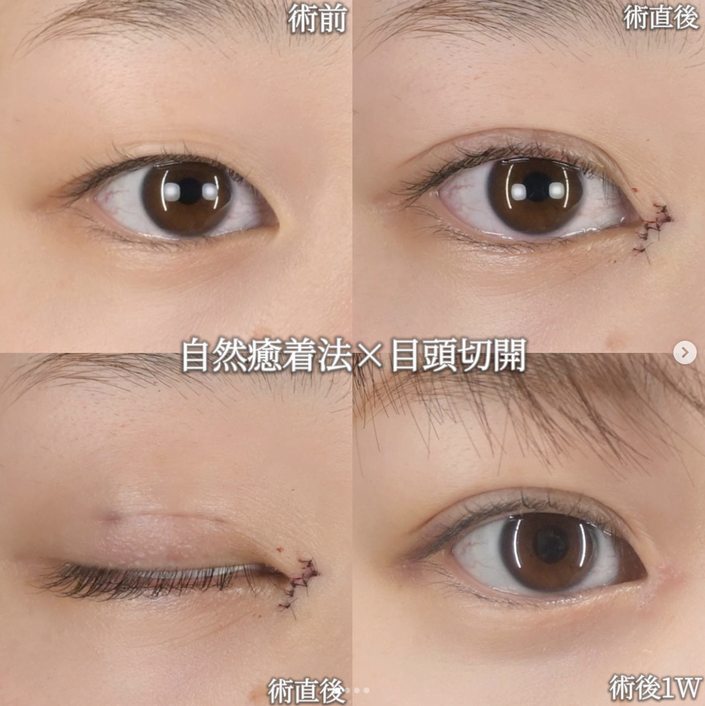 症例写真