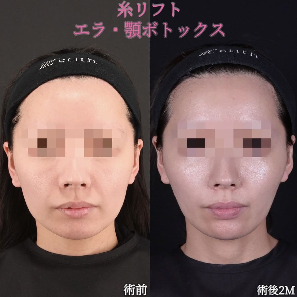 症例写真