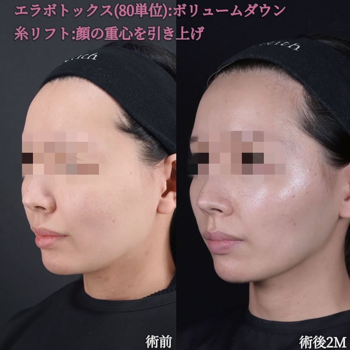 症例写真