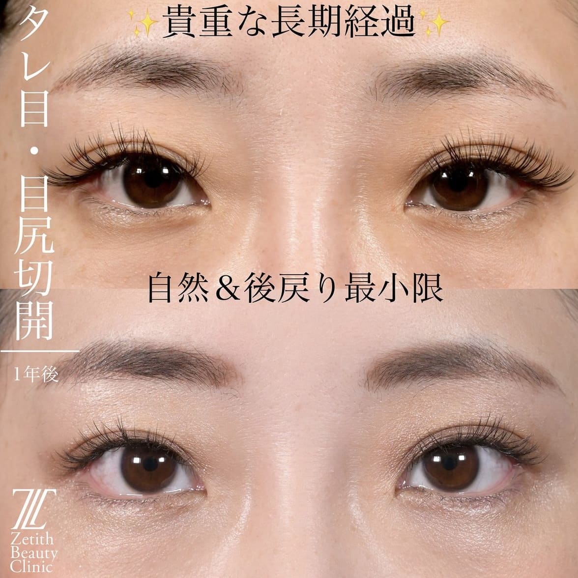 症例写真