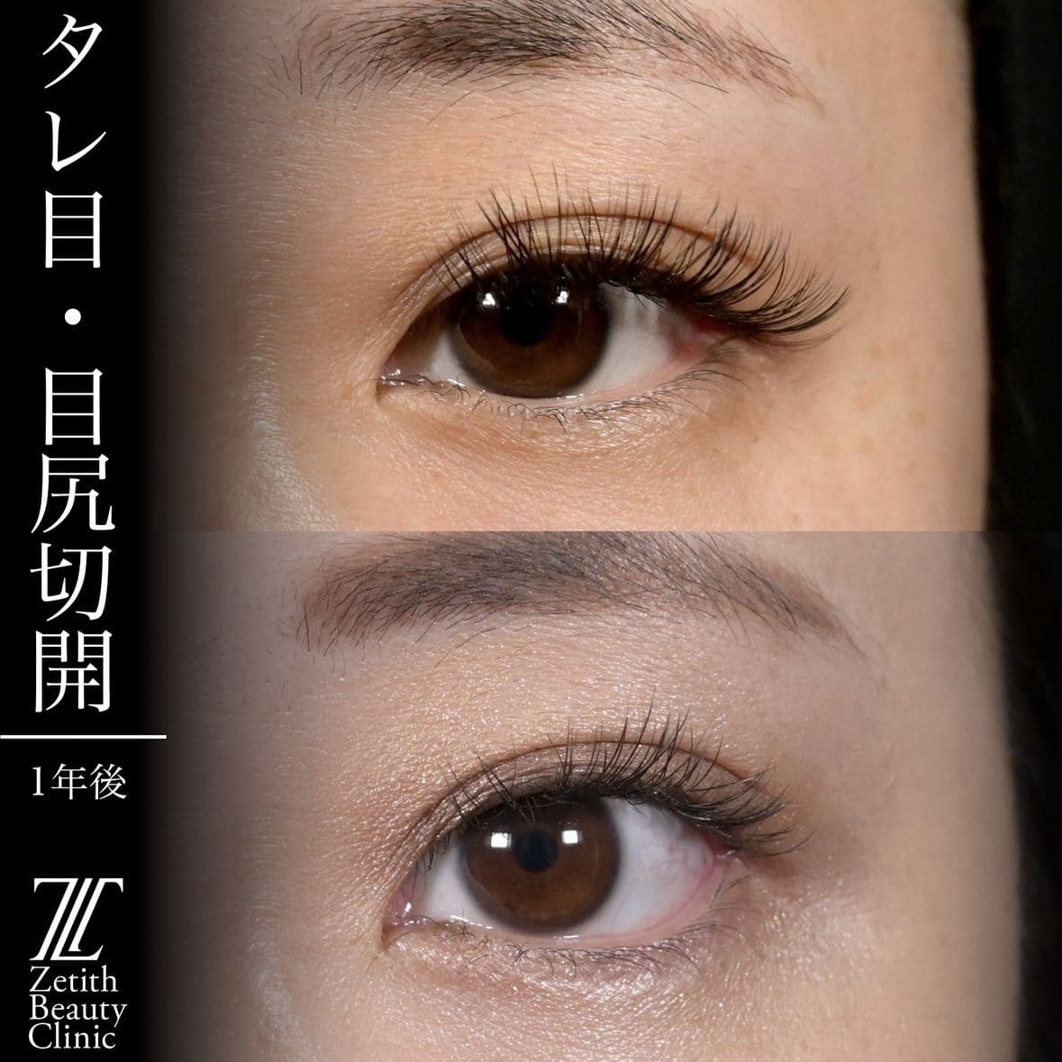 症例写真
