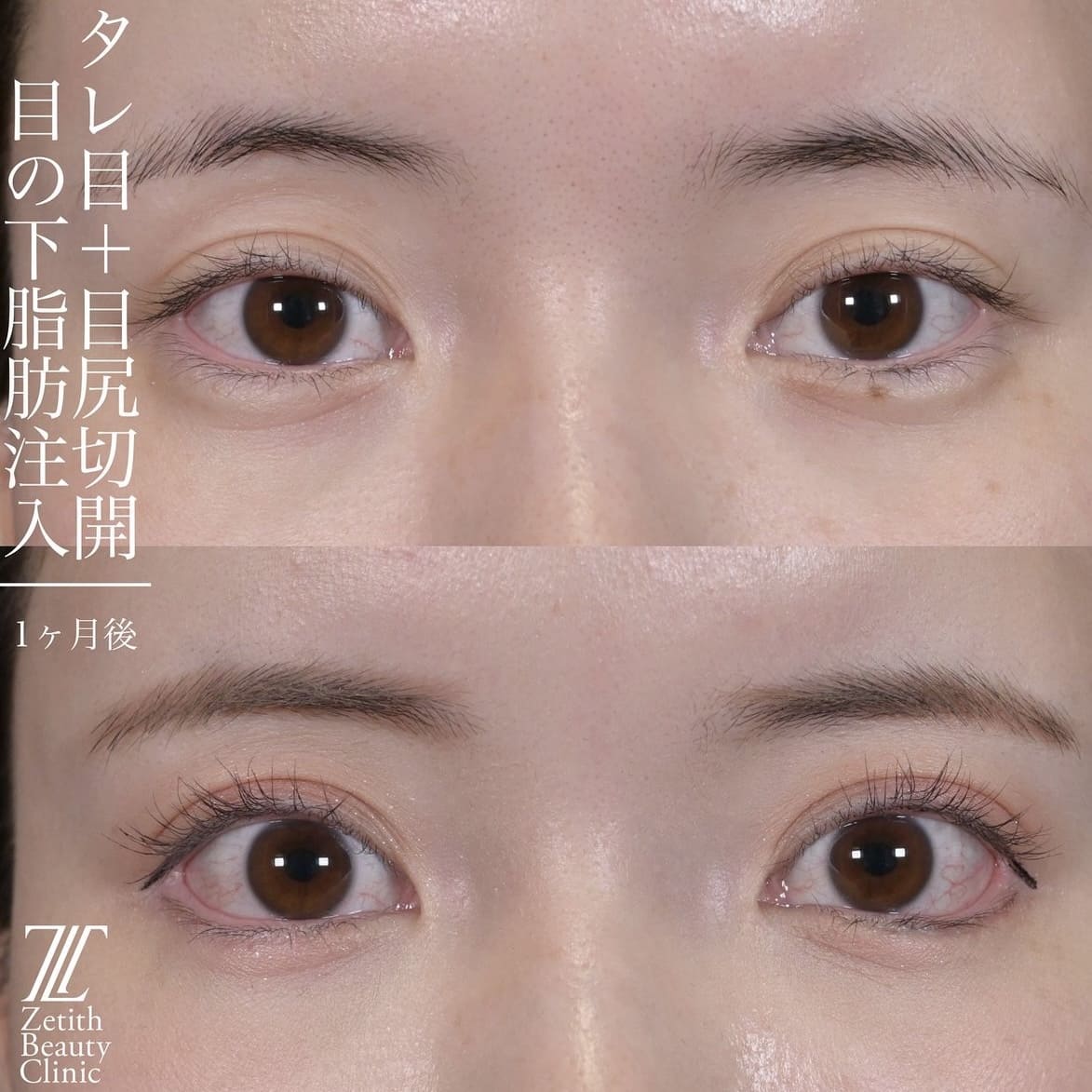 症例写真