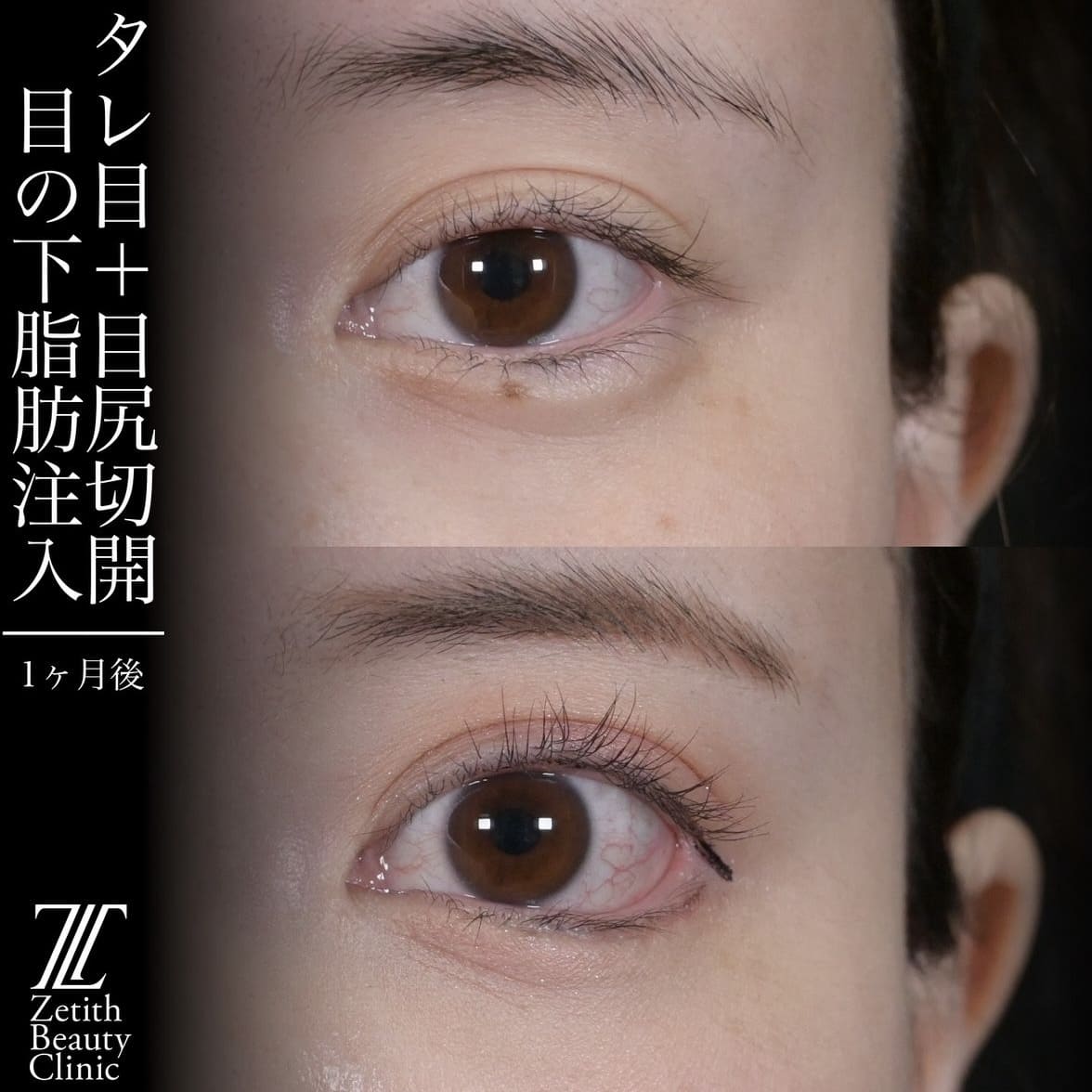 症例写真
