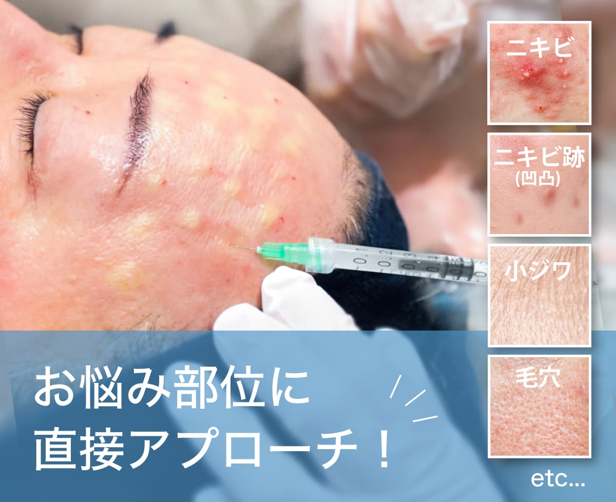 局所注射ができる