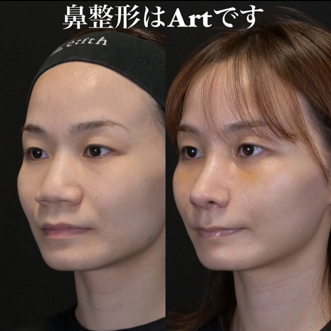 症例写真
