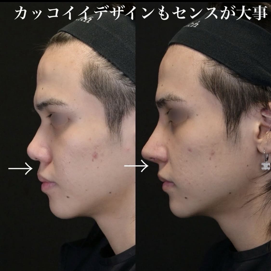 症例写真