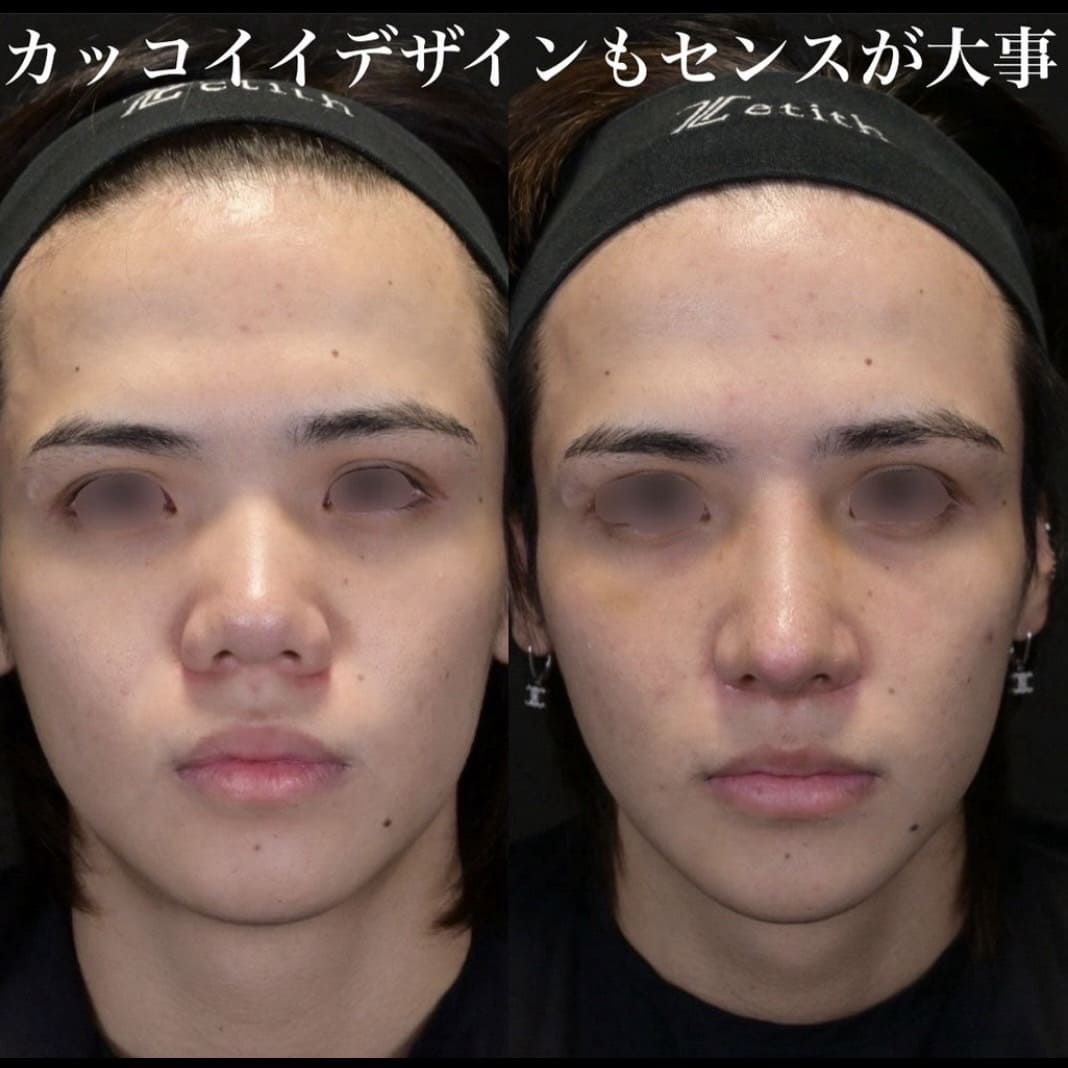 症例写真