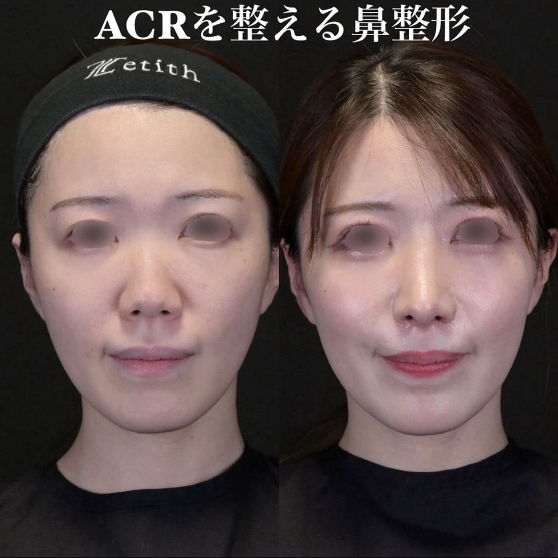 症例写真
