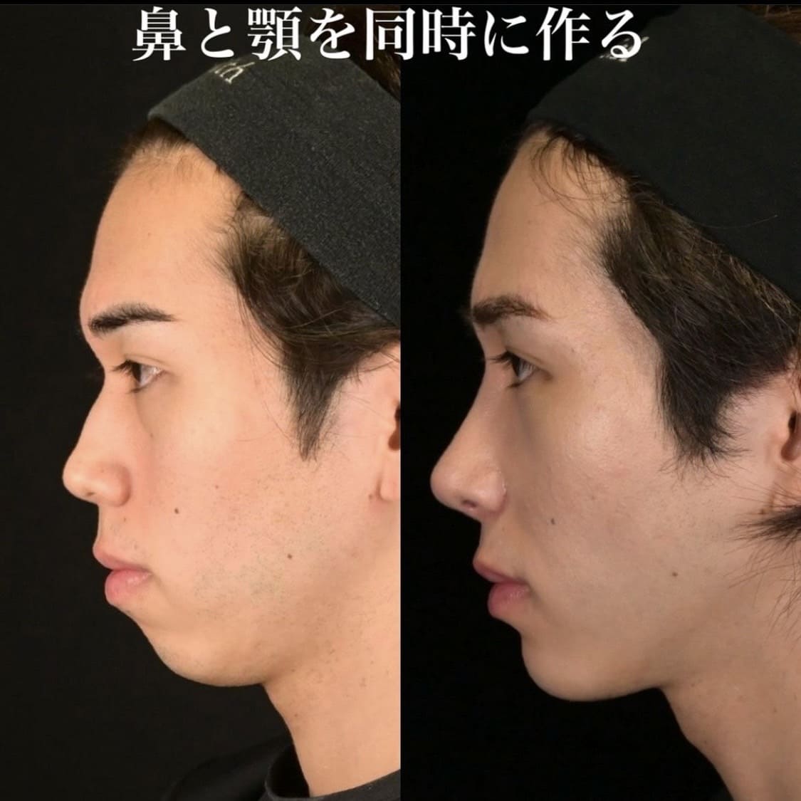 症例写真