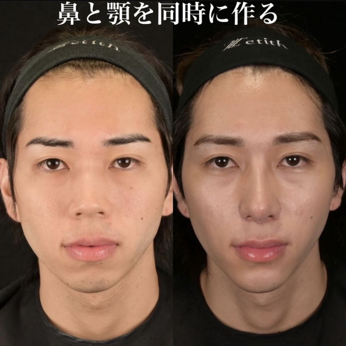 症例写真